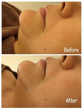 ラオン(laon)/トータルハイドラケア