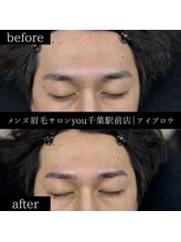 ユー 千葉駅前店(you)/ビフォ－アフター写真
