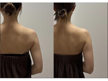 スキャプレーン 米子(SCAPLANE)/BEFORE AFTER事例