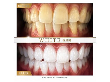 ホワイト 香里園店(WHITE)の写真