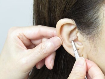 アミージュ(amige)/施術の様子