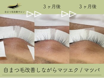 アンモス(Ann Moss)/話題の【自まつ毛改善マツエク】