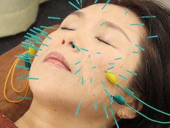 鍼灸アニマート治療院