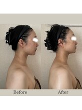 リーブル(LIBRE)/小顔コルギ　初回