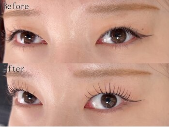 チュアリポノ/エクパ80本/アンドヘルシー