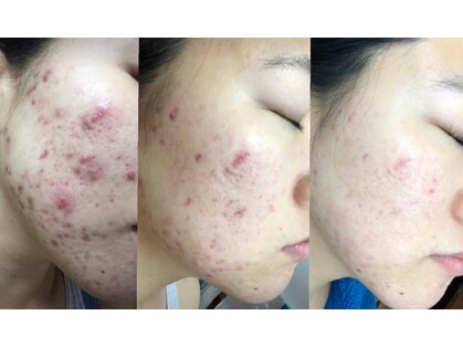 パールプラス 総社店(Pearl plus)の写真