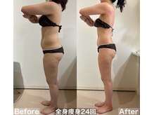 ヴィクシア(VIXIA)/痩身90分