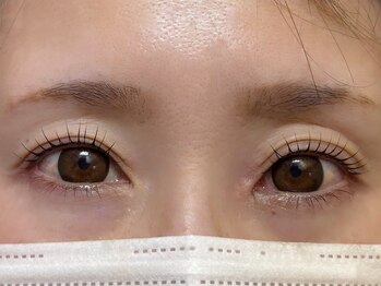 エイジレス(AGELESS)/ポイント→二重幅の左右差改善