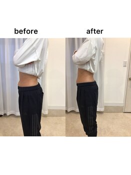 ジョワイユ(Joyeux)/腸の位置でお腹は変わる