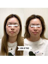 ゆうだい整骨院/美容鍼も小顔矯正も合わせて◎