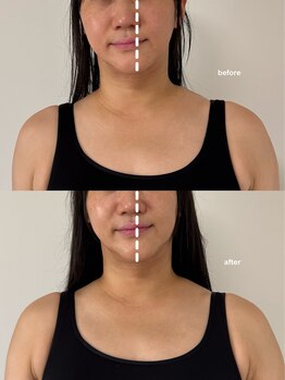 こつこつラボ サンイチマル オオル(310/OOL')/［40代/歪み/左右差/たるみ］