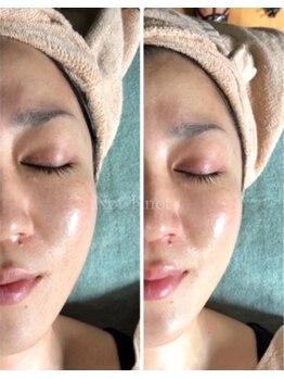 ノットノット 自由が丘(Not Knot)/リアボーテ ACトリートメント