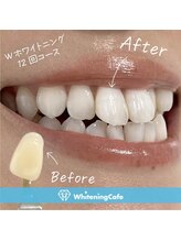 ホワイトニングカフェ 千葉店/ホワイトニングビフォーアフター
