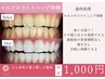 歯科提携★セルフホワイトニング体験<15分×1照射>【初回限定】