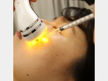 健志接骨院/臍帯血幹細胞培養液60％導入！