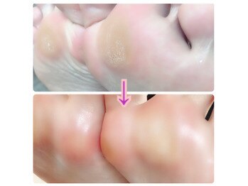 ネイルサロン アテナ(Athena)/Foot美爪ウォーターケア&角質