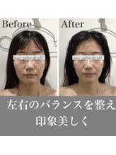 ハリサロンドオフ 心斎橋店(hari salon de off)/お顔の左右差整う！