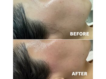 ベレア(BELEA)/耳にかけた時に産毛見落としがち