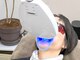 サン(Sun)の写真/着色が気になる・黄ばみが気になる方必見！【セルフホワイトニング】で輝く白い歯に、自信がもてる笑顔に♪