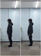 カルペード 中百舌鳥/なかもず院(Carpe D.)/施術後の変化