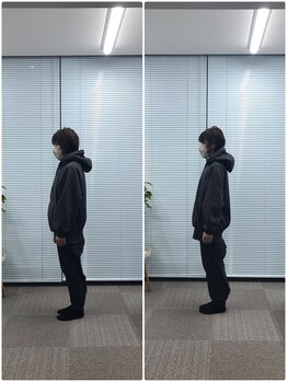 カルペード 中百舌鳥/なかもず院(Carpe D.)/施術後の変化