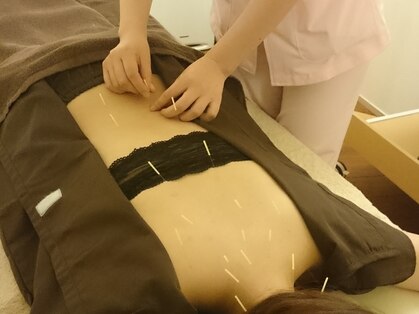 はり灸心音の写真