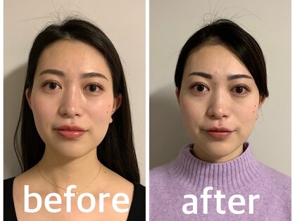 骨格美容サロンの写真