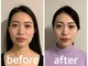 骨格美容サロンの写真