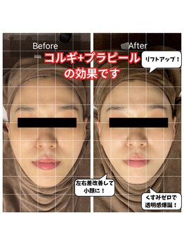 チョアチョア 札幌すすきの店(CHOA-CHOA)/