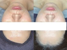 エモーショナル 姫路(Emotional)/４回目の変化