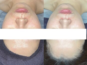 エモーショナル 姫路(Emotional)/ララピールLDM 4回目の変化