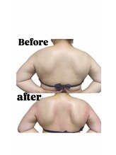 ソバニ(SOBANI)/肩甲骨整えて痩せ見え