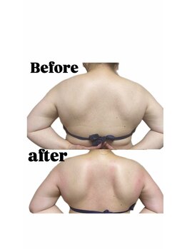 ソバニ(SOBANI)/肩甲骨整えて痩せ見え