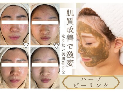 ルーセントの写真