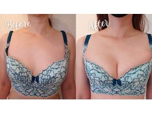 サロンハナ(Salon HANA)の雰囲気(ベテランの技術+光+ナノカレント効果で戻らないバスト)