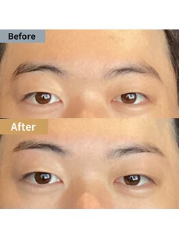 眉毛ハウス 吉祥寺店(眉毛HOUSE)/お客様の施術例(吉祥寺/東京)