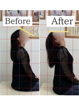 ナオル整体 仙台長町院(NAORU整体)/整体・矯正ビフォーアフター