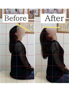 ナオル整体 仙台長町院(NAORU整体)/整体・矯正ビフォーアフター