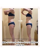 ソラウミ(SORAUMI)/本気痩せ！痩身セルゼロ6回