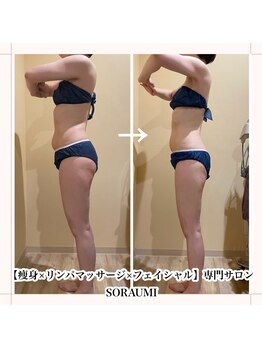 ソラウミ(SORAUMI)/Before→After6回