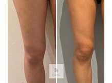 レミュ(Remu)/脂肪燃焼液10ml