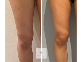 レミュ(Remu)/脂肪燃焼液10ml