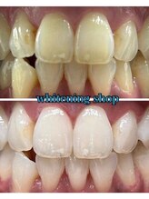 ホワイトニングショップ 恵比寿店/フリーパス終了のお客様