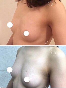 ラディス(Radice.)/下乳ラインでくっきりバストケア