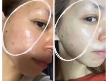 スリリアン 銀座/★お客さまビフォーアフター★