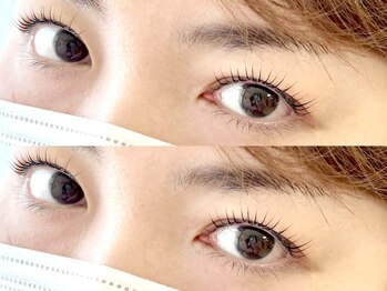 シエンテ(Ciente)/奥二重さん