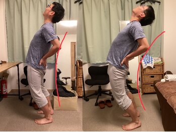 たすき鍼灸治療院/動けない腰痛と鍼灸