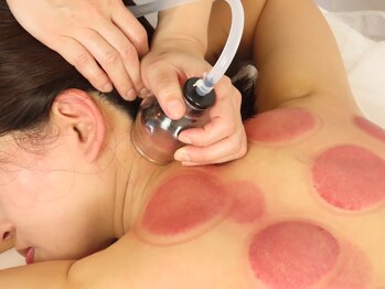 ウラヤス 恵比寿(Urayasu)/スライドカップドレナージュ