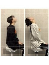 博多おかげ整体院/猫背による首凝り改善！