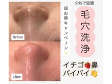 ラルガ 城野店(Raruga)の雰囲気（SNSで話題の韓国式毛穴洗浄☆鼻WAX付きでツヤツヤ鼻へ♪）